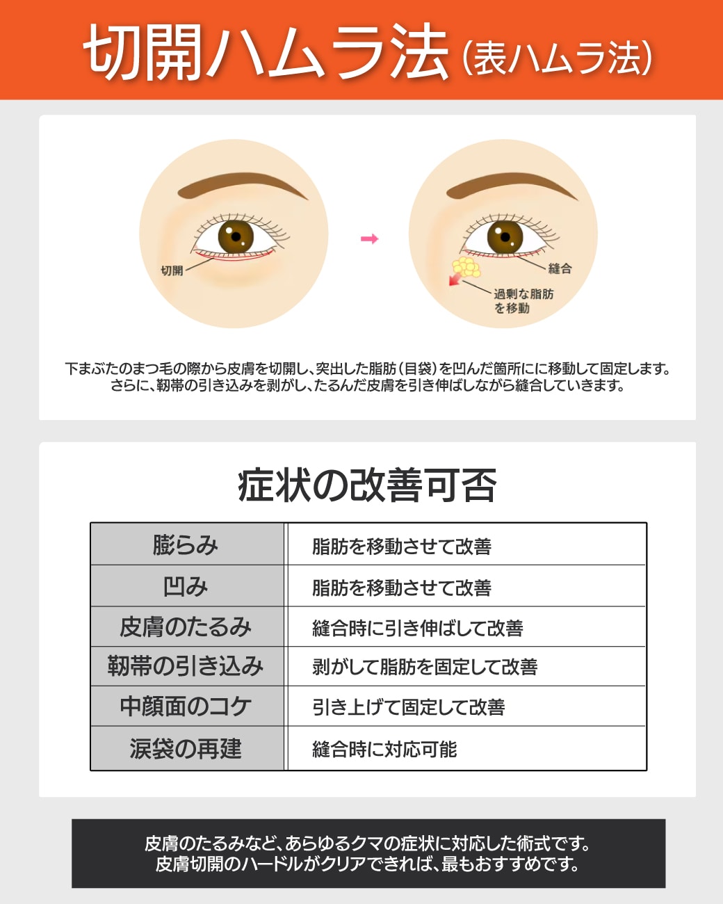 【人気No.1】切開ハムラ法