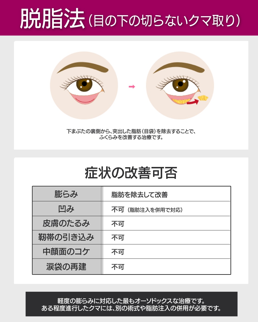 【軽度のふくらみ】脱脂法（目の下の切らないクマ取り）