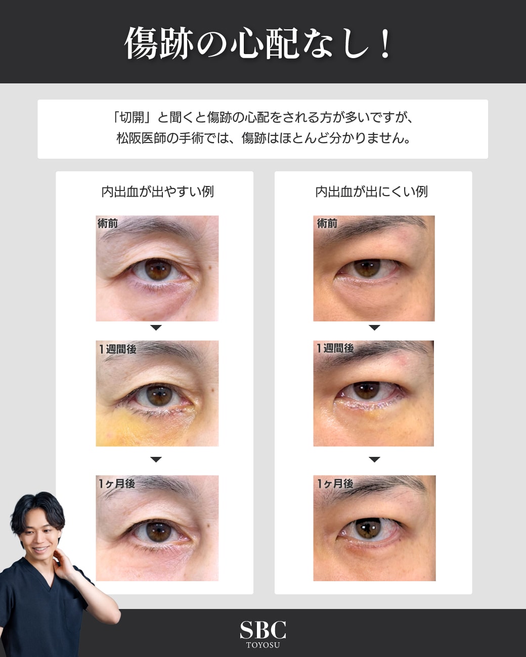 ダウンタイムも安心して過ごす