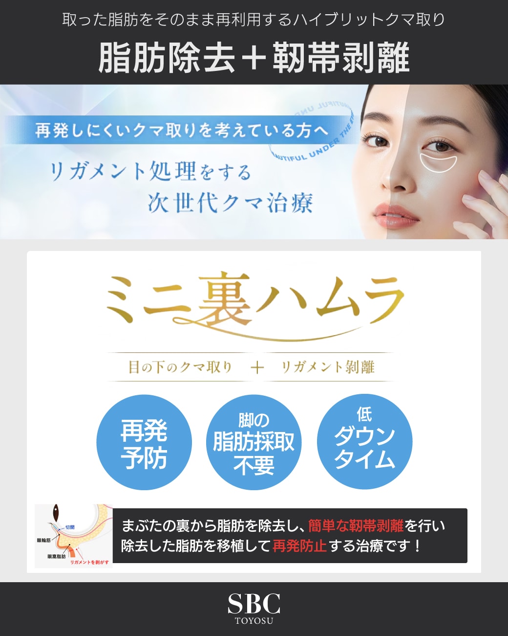 脂肪除去＋靭帯剥離