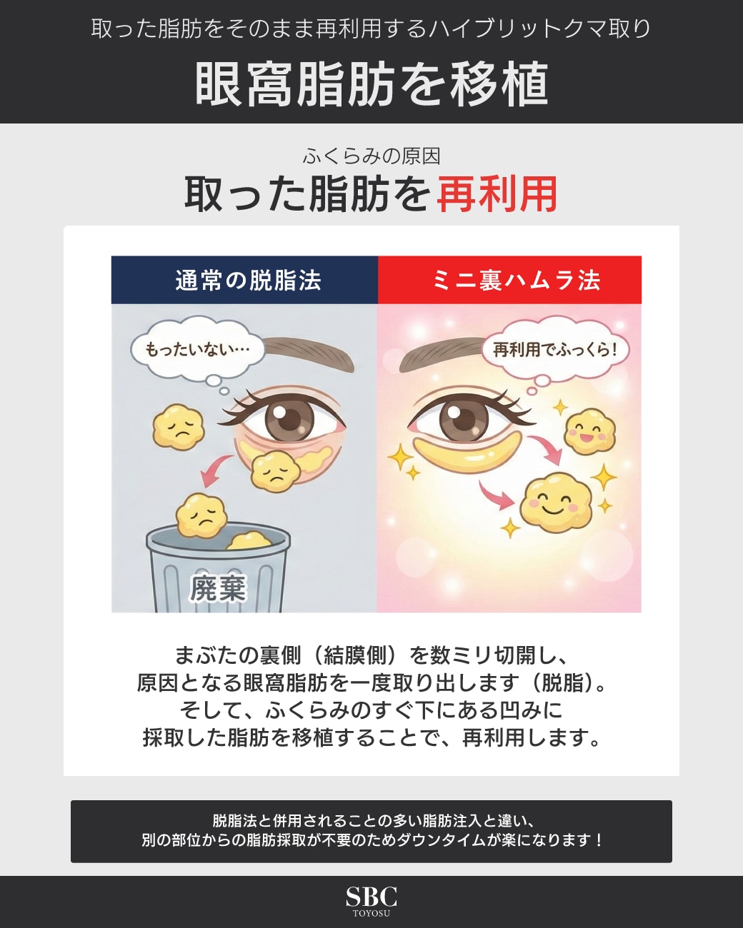 取った脂肪を再利用