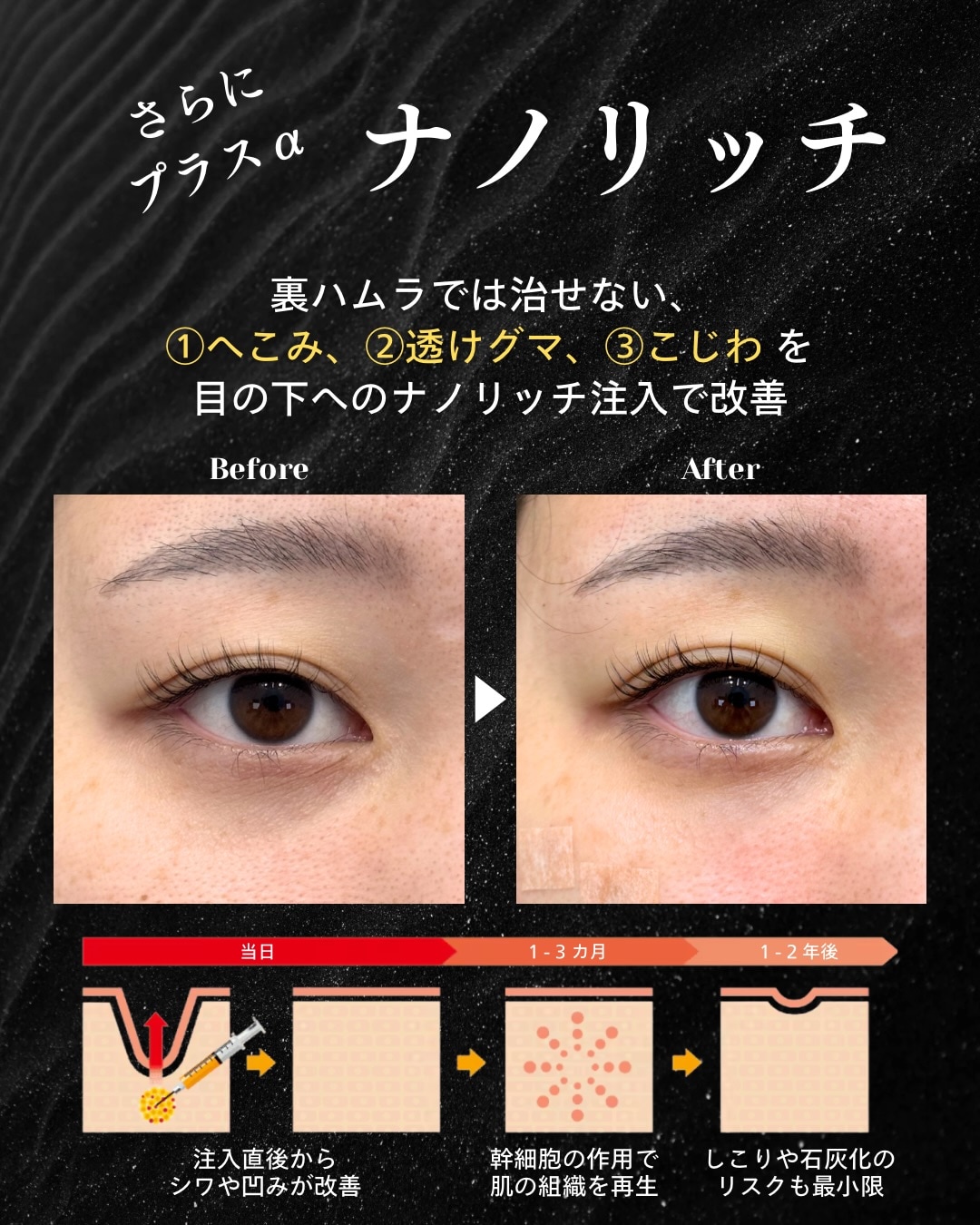 完璧な目元を目指す「ナノリッチ」