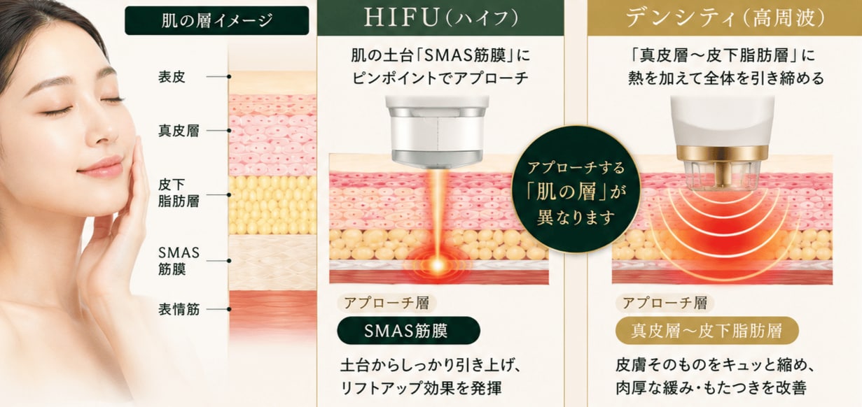 定番の「HIFU（ハイフ）」とは何が違うのですか？一緒に受けることはできますか？