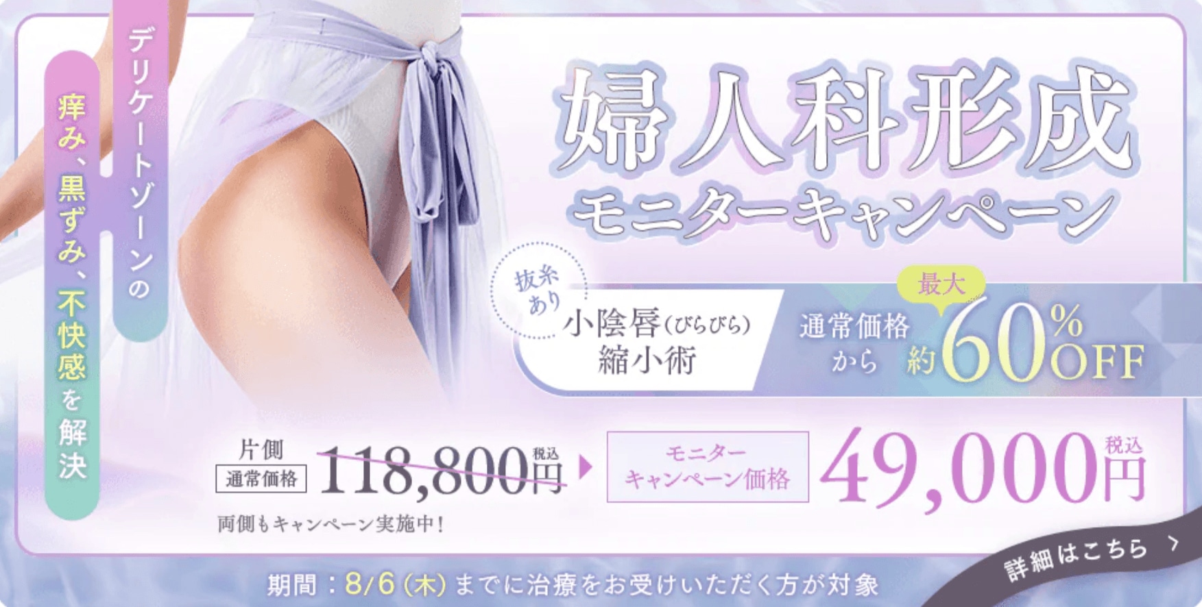 婦人科形成 モニターキャンペーン（小陰唇縮小術・抜糸あり）