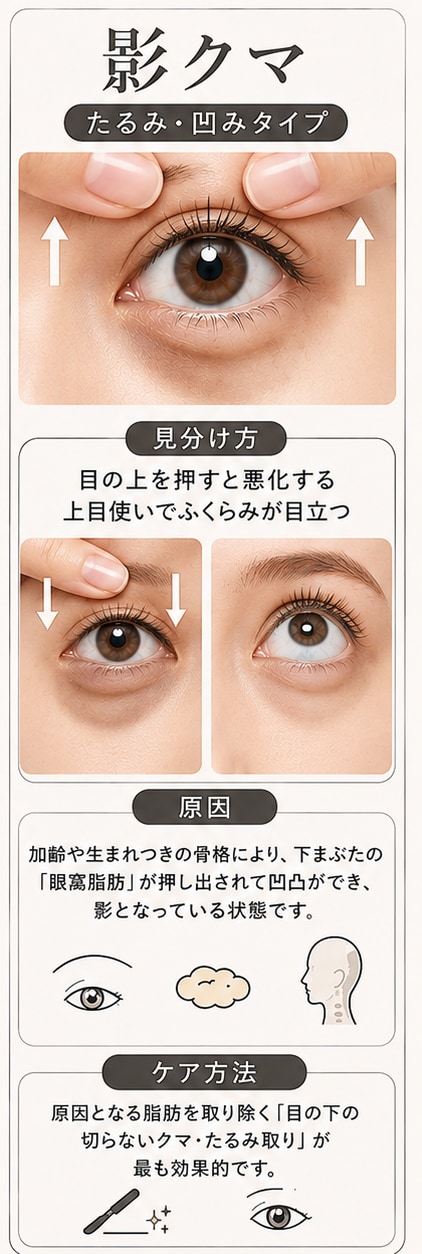 最も多いお悩み！脂肪のふくらみによる「影クマ（黒クマ）」
