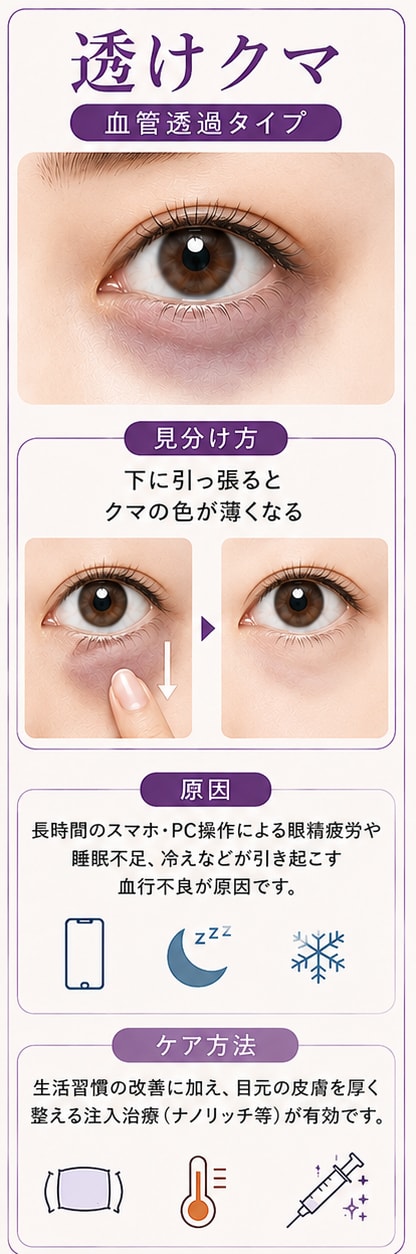 血行不良や皮膚の薄さが原因の「透けクマ」