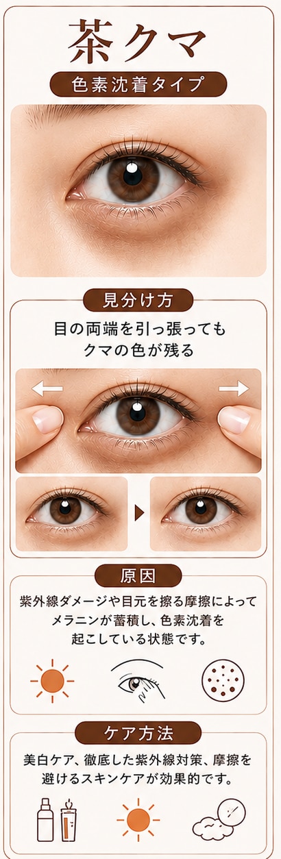 メラニンの蓄積による「茶クマ」