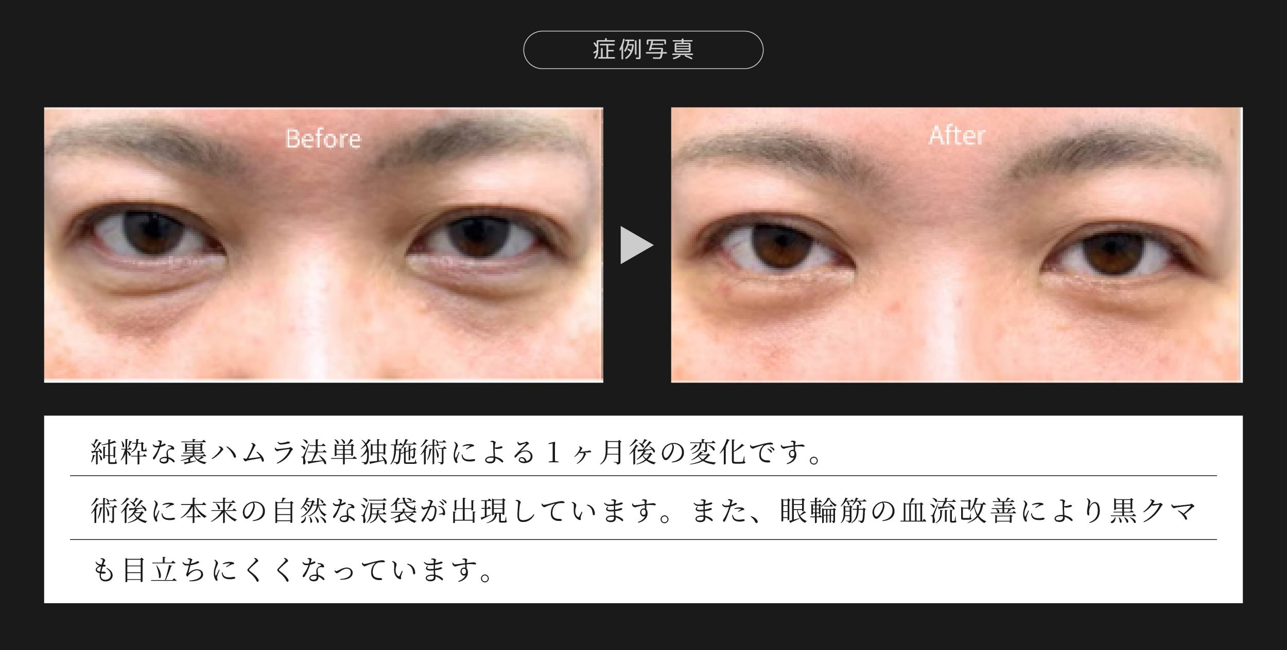 セプタルリセット 2枚目