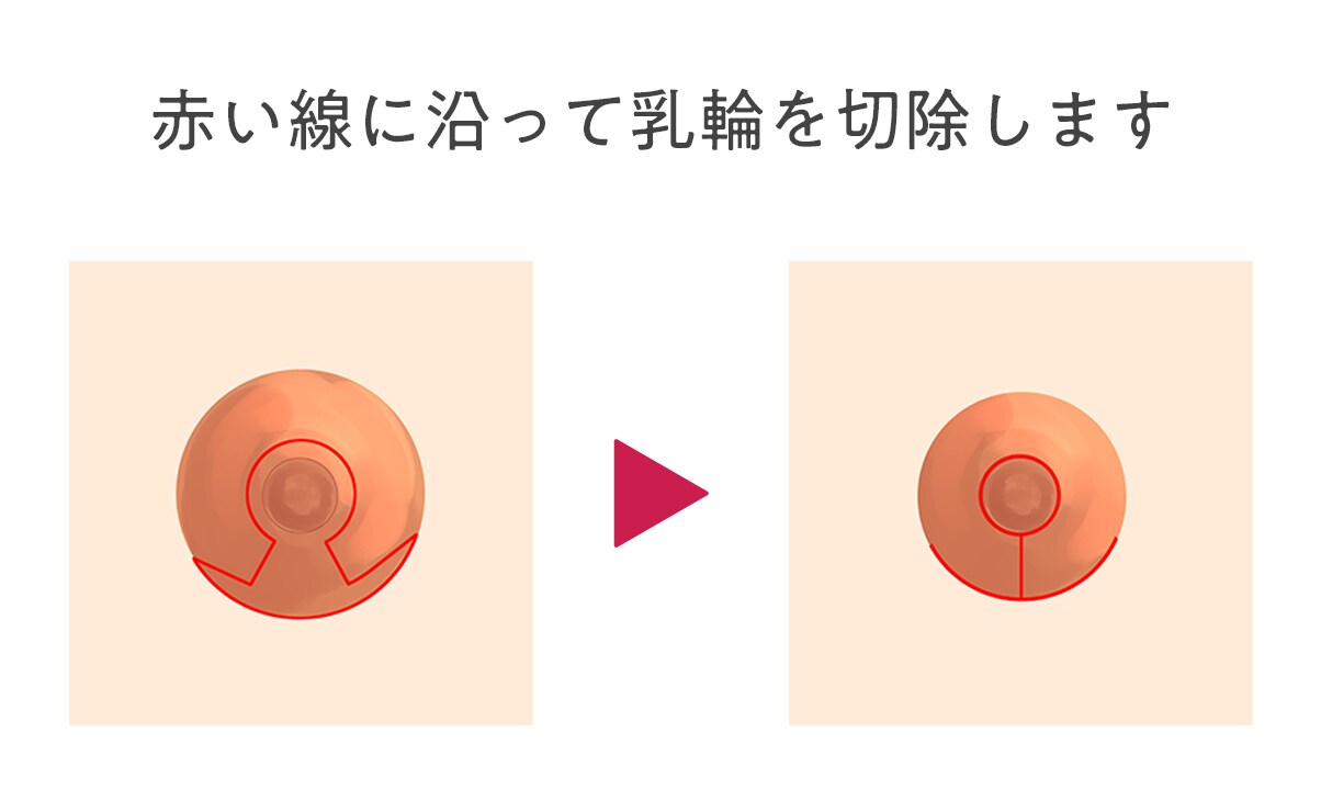 乳輪 