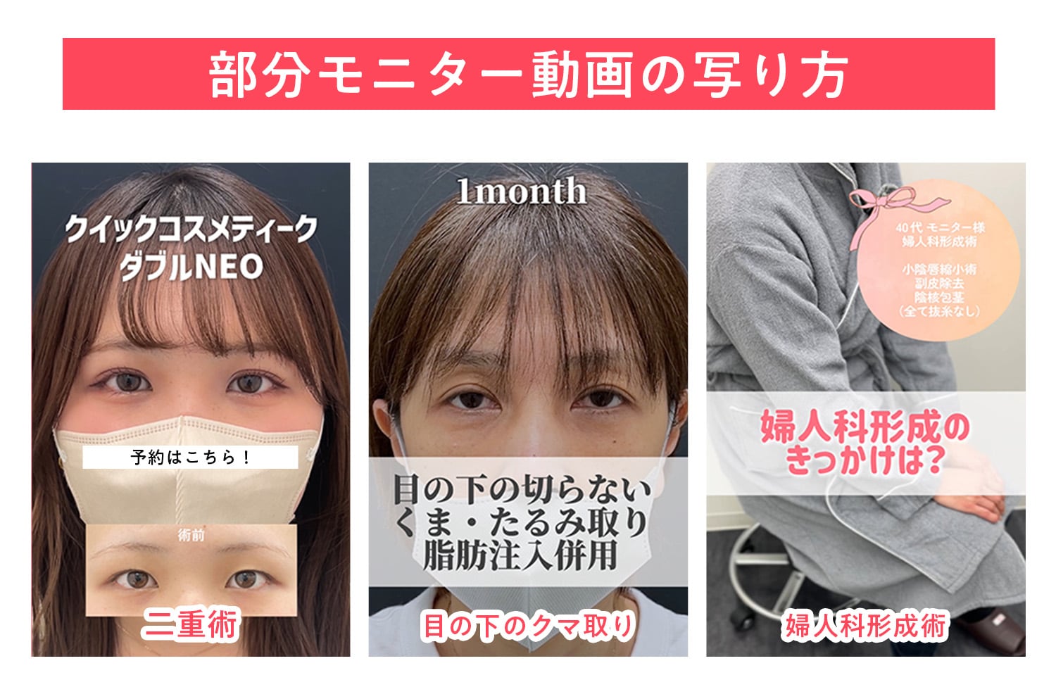 湘南 美容 外科 モニター