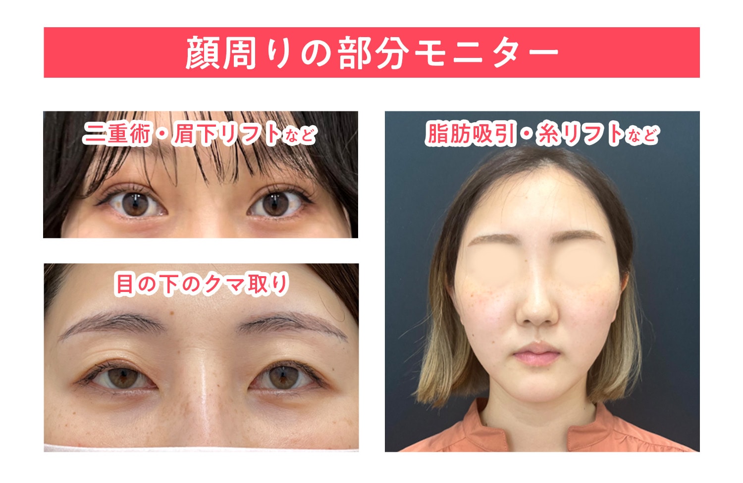 湘南 美容 外科 モニター