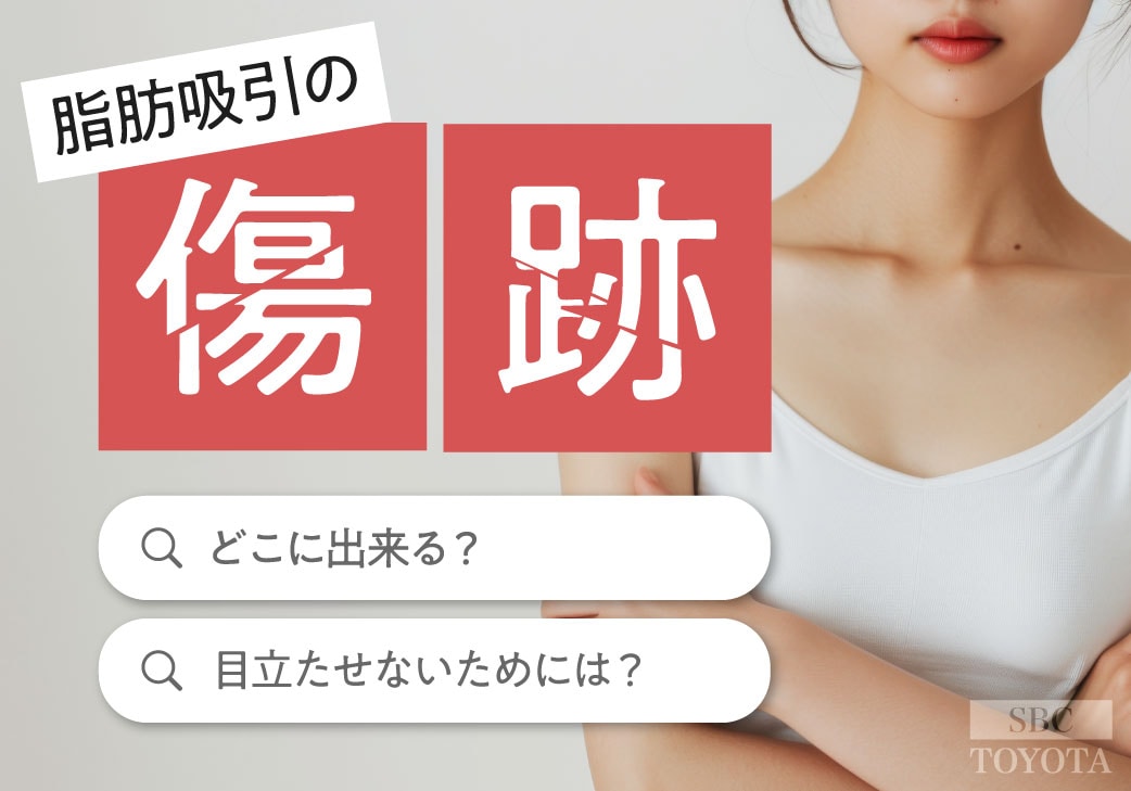 脂肪吸引の傷はどこにできる？実際の症例で見る傷跡とケア方法｜湘南美容クリニック豊田院