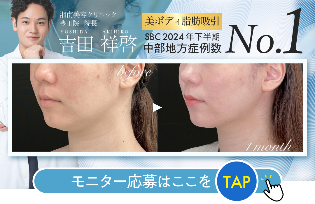 中部エリアNo.1の脂肪吸引