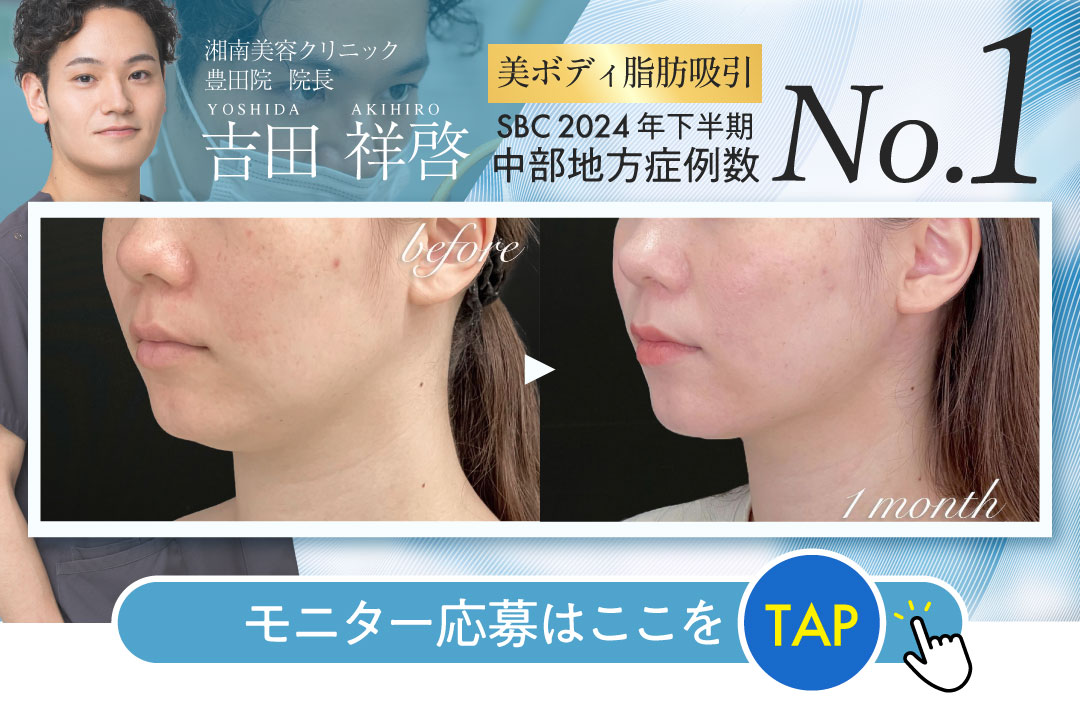 中部エリアNo.1の脂肪吸引