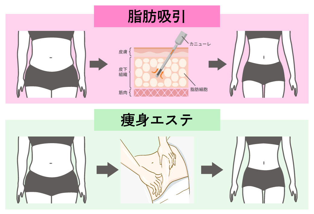 各施術のメカニズム