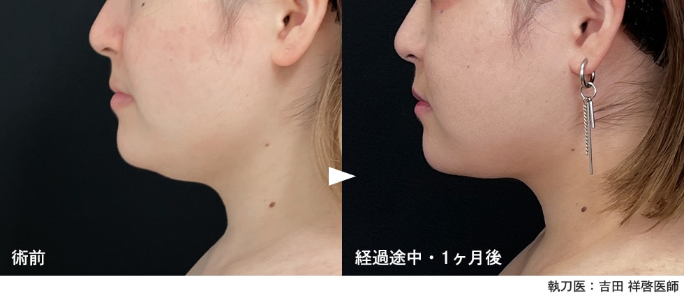 <b>あき先生なら1ヶ月目でもしっかり変化が出ます✨</b>