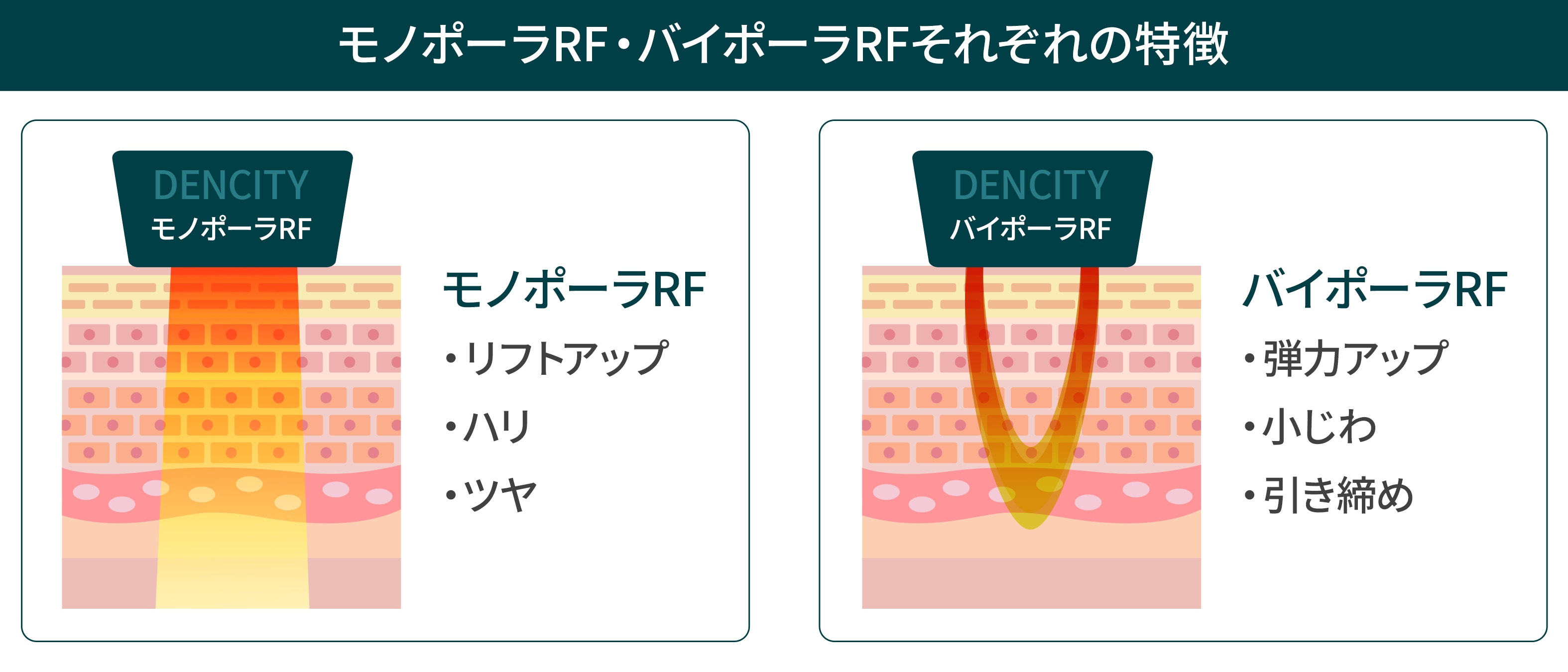 それぞれの特徴