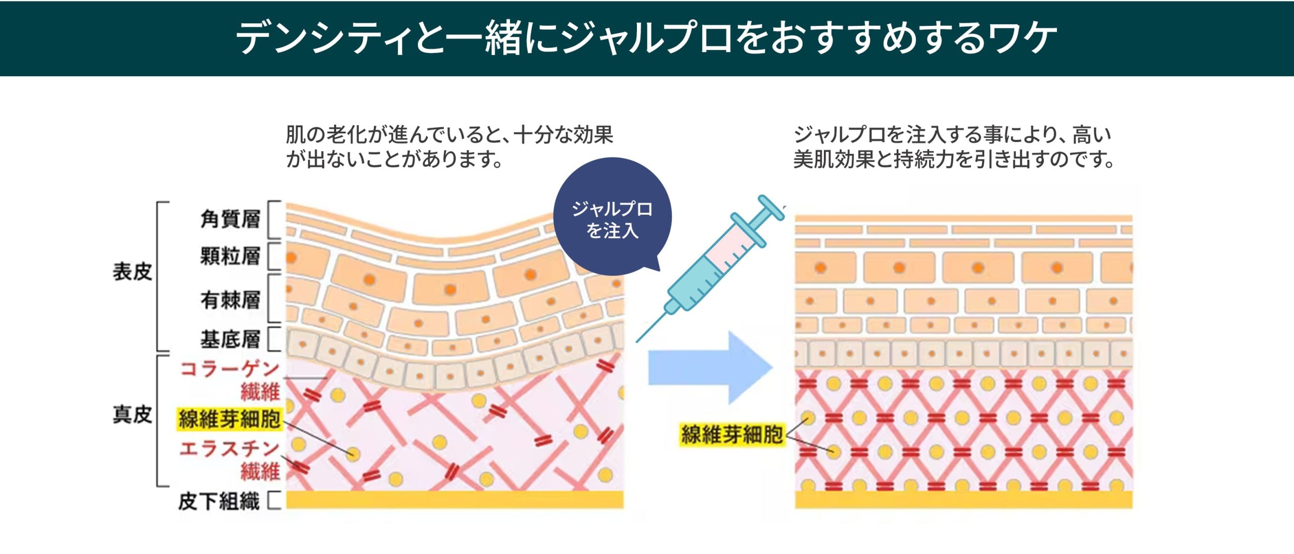 なぜ一緒に受けるといいの?