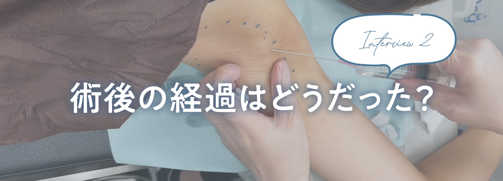 思ったより腫れなかった