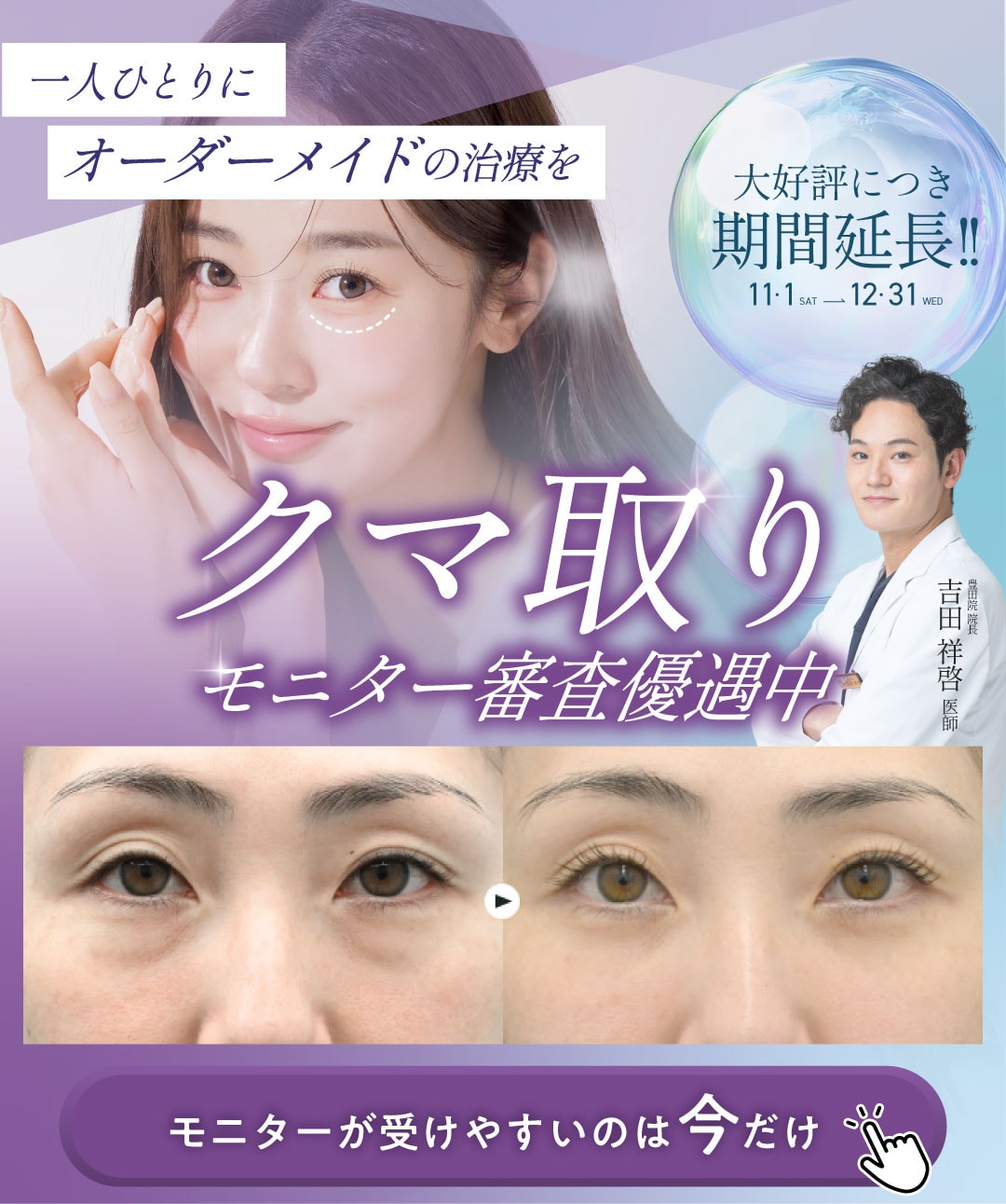 【12月限定】クマ取りモニター審査優遇中