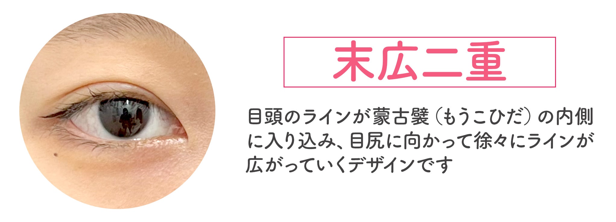 末広（すえひろ）二重