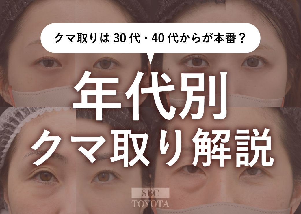 クマ取りは30代・40代からが本番？年代別の解決方法とリアルな症例解説｜湘南美容クリニック豊田院