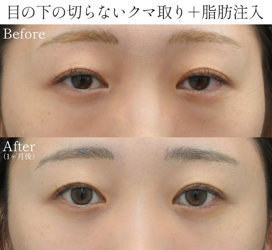 【20代】生まれつきある遺伝や骨格が要因で悩む方が多い