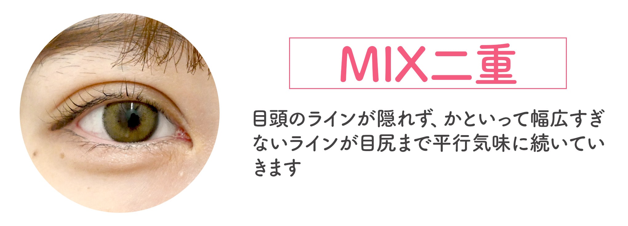 MIX（ミックス）二重