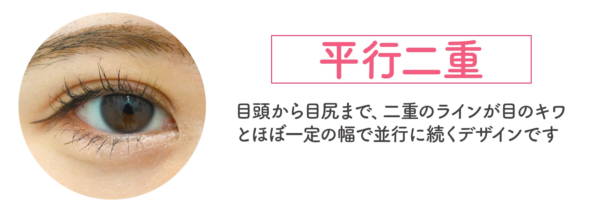 平行（へいこう）二重