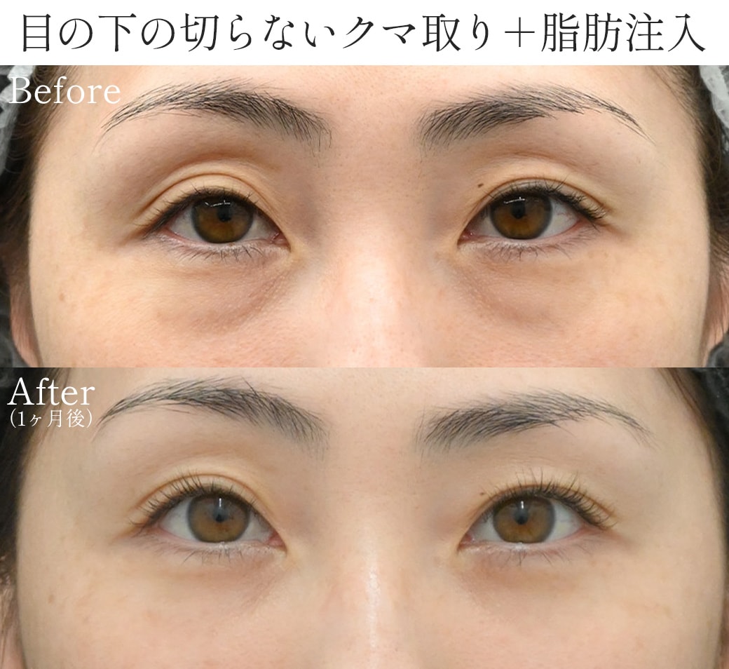 【40代】お疲れ顔」から「老け顔」への変化に悩む方が急増