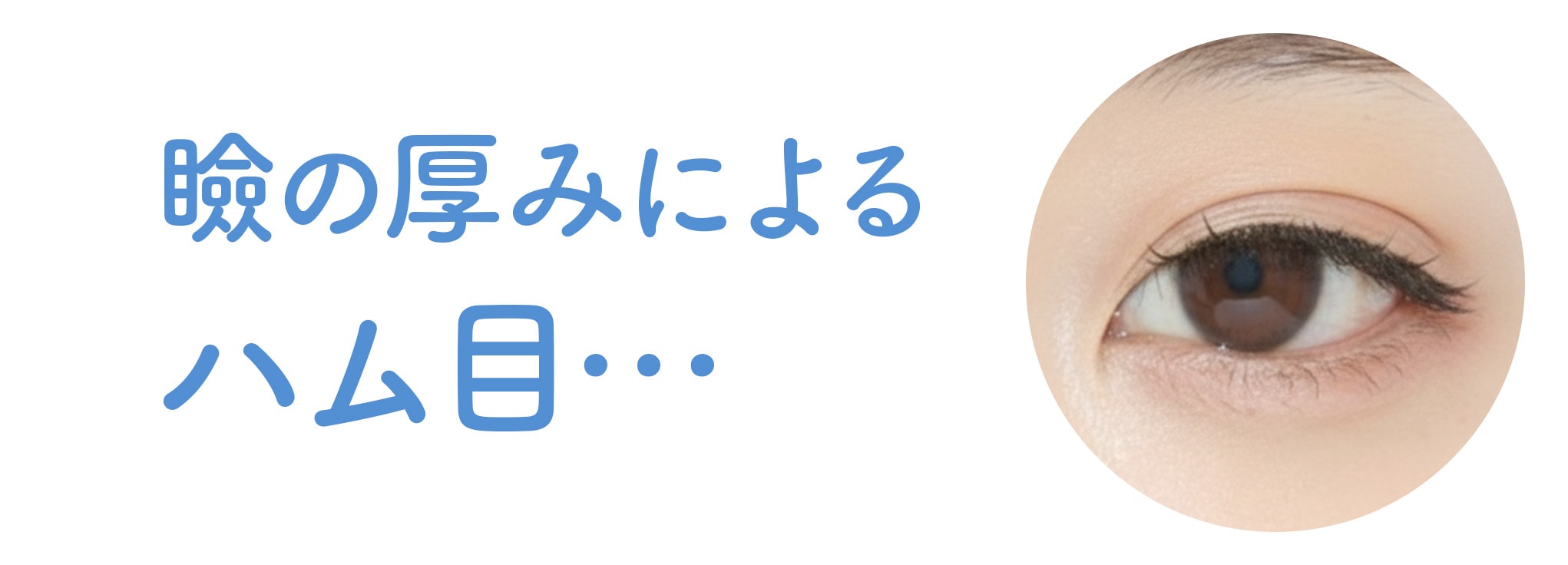 まぶたの厚みを無視すると「ハム目」の原因に