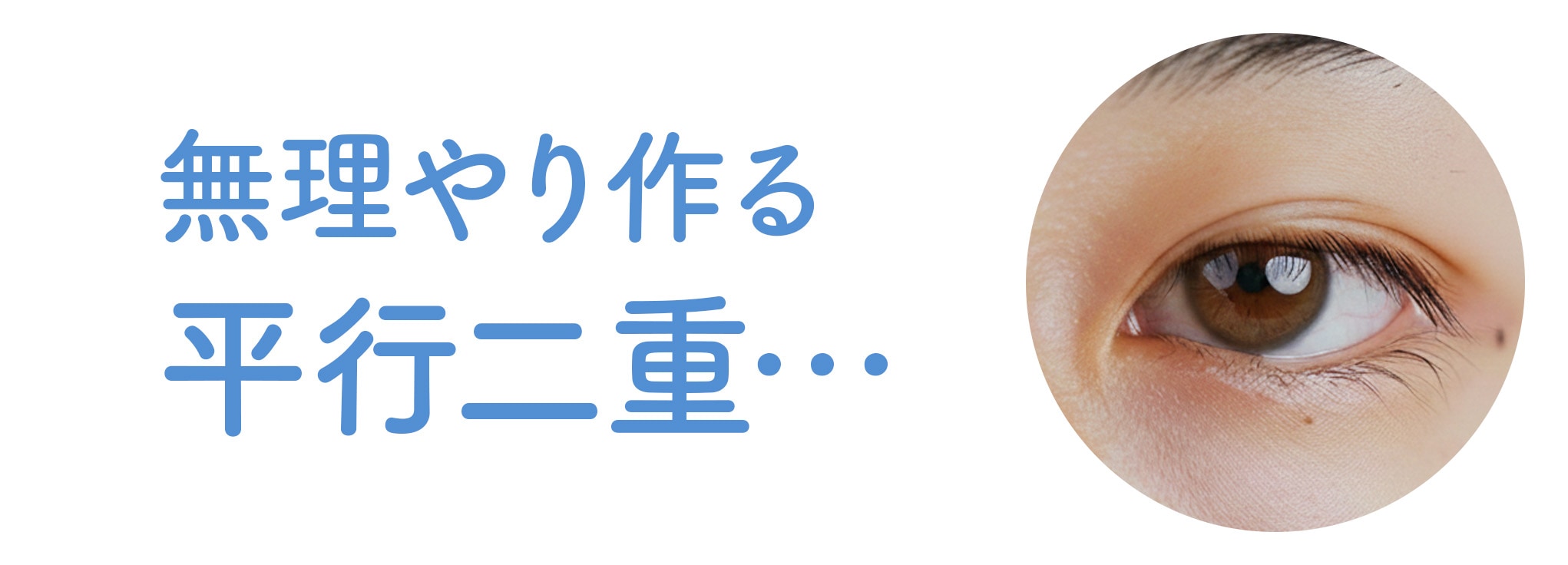 蒙古襞（もうこひだ）を無視した「無理な平行」