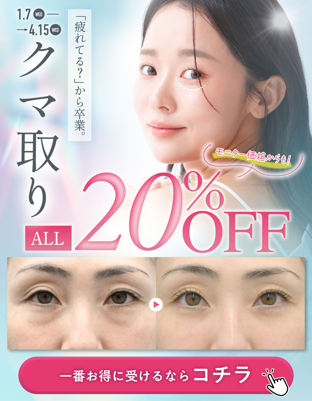 今ならクマ取り全メニュー20%OFF