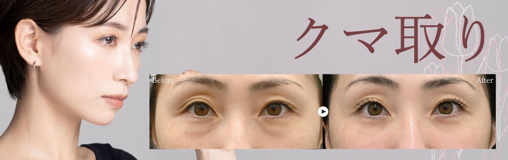 豊田院人気No.1🐻クマ取り