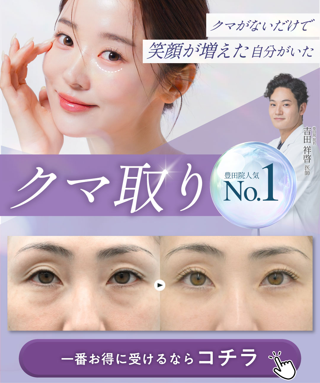 若返り人気No.1のクマ取りを受ける