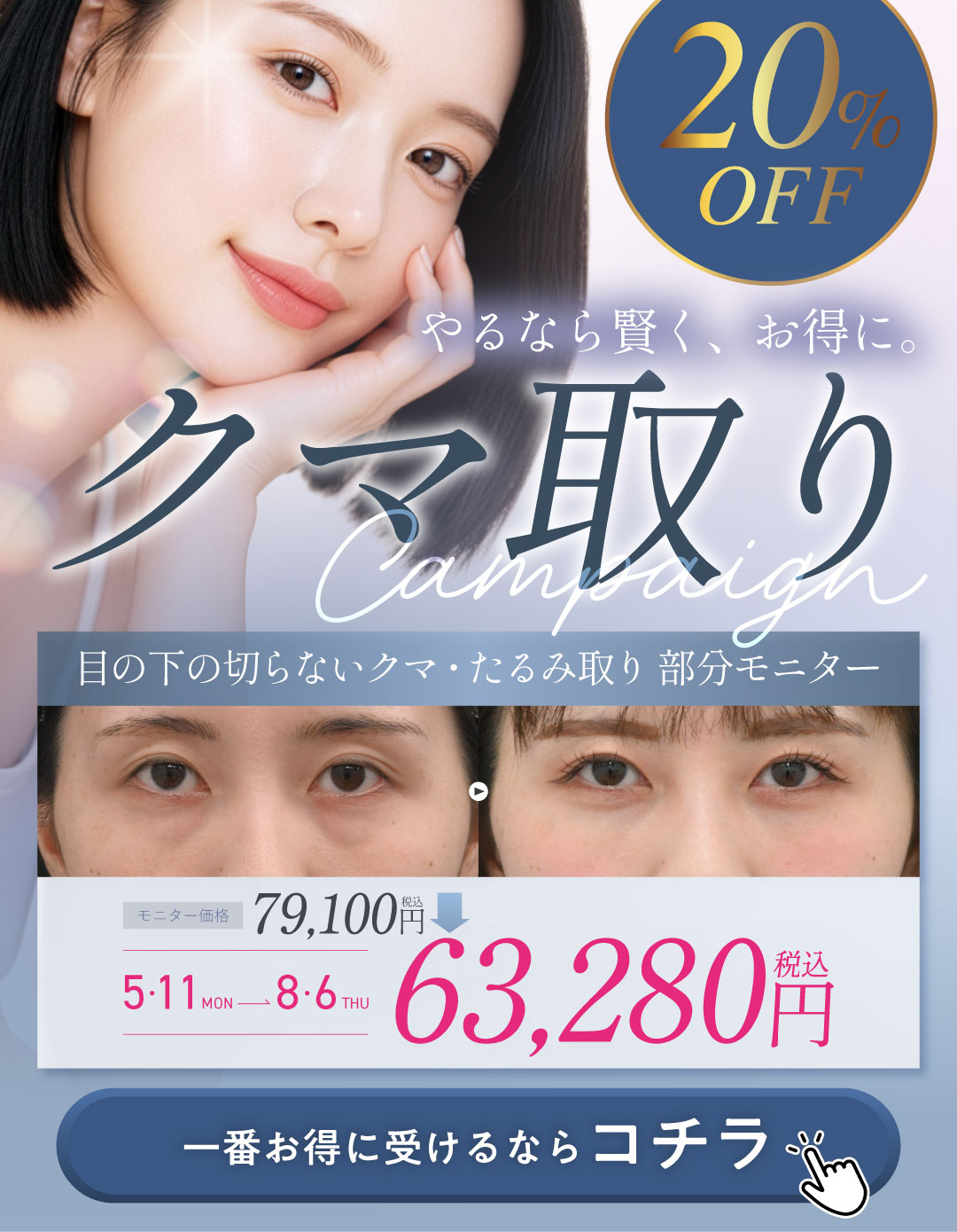 モニター価格からさらに20%OFFでクマ治療を受ける