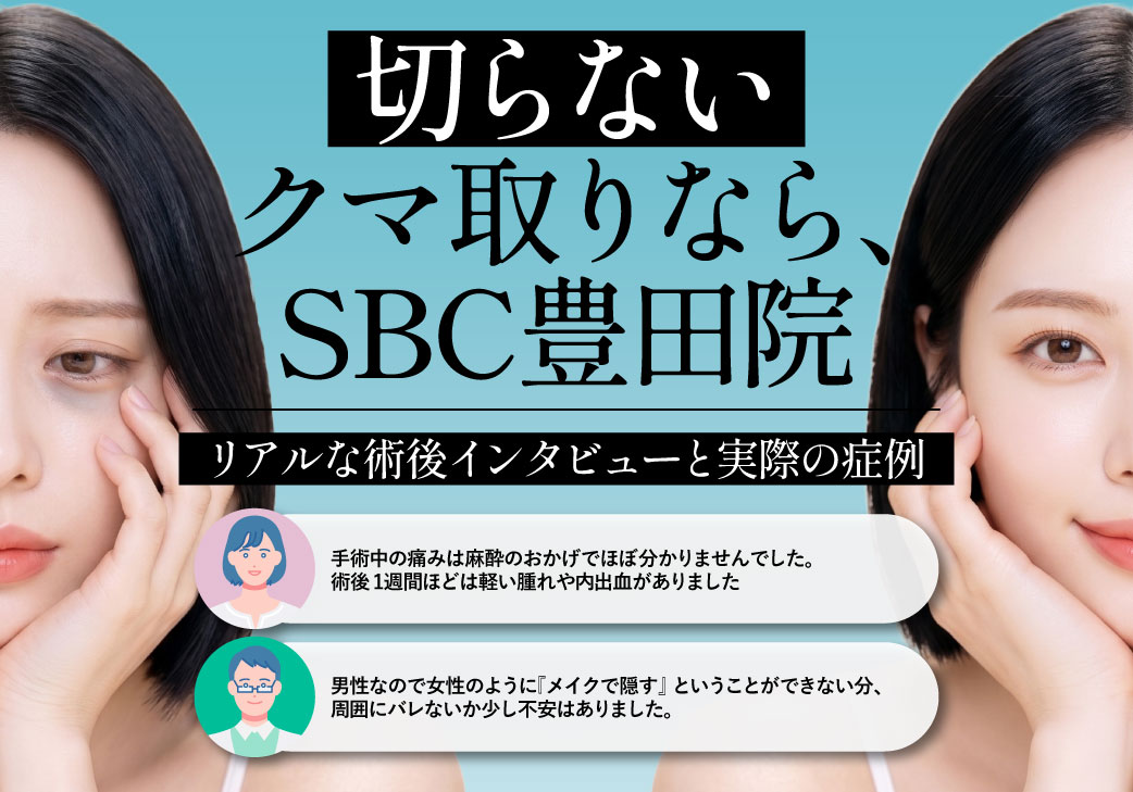 切らないクマ取りならSBC豊田院｜リアルな術後インタビューと実際の症例