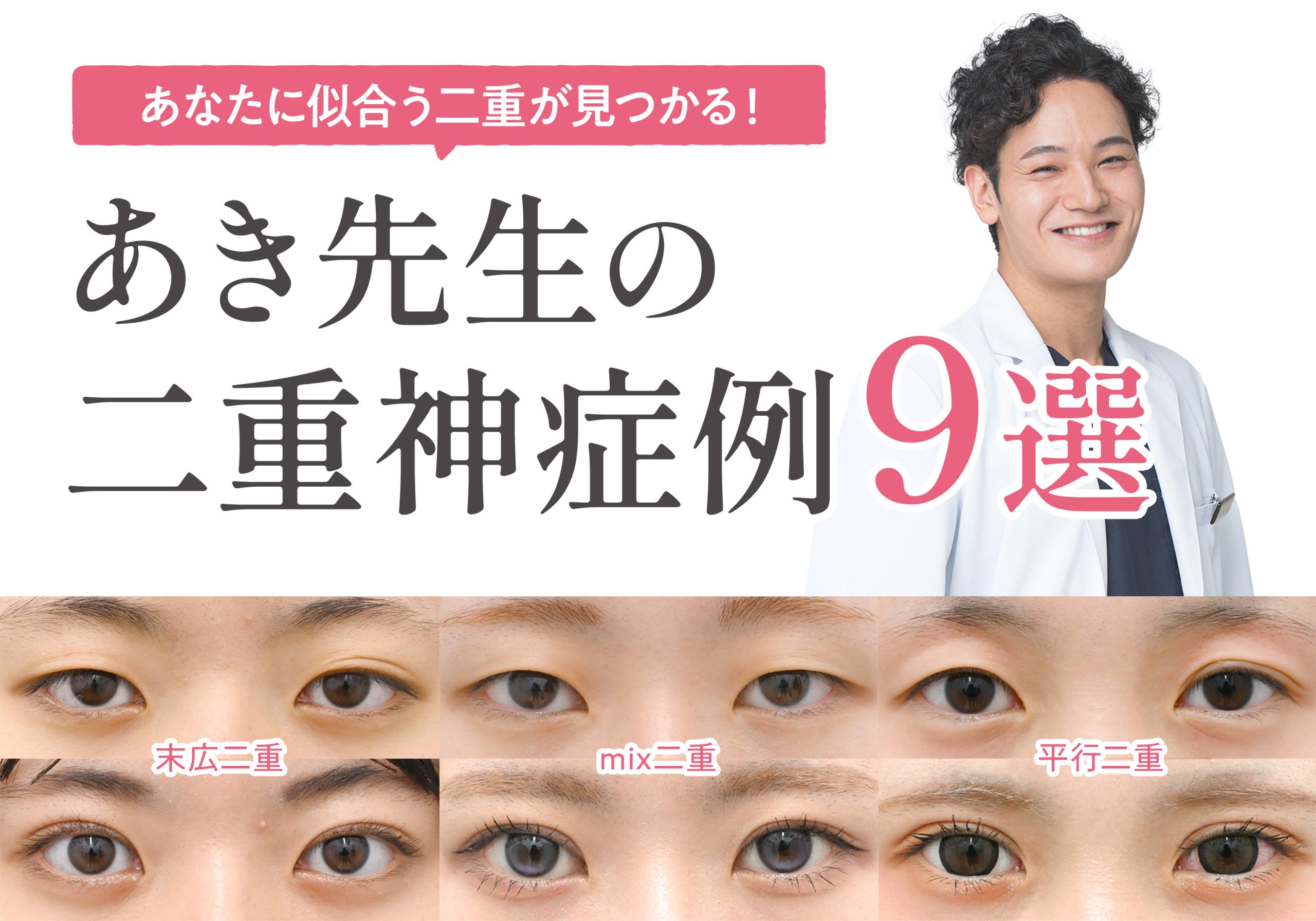 【二重神症例】あき先生の二重術が選ばれる理由！理想の目元になれる症例まとめ