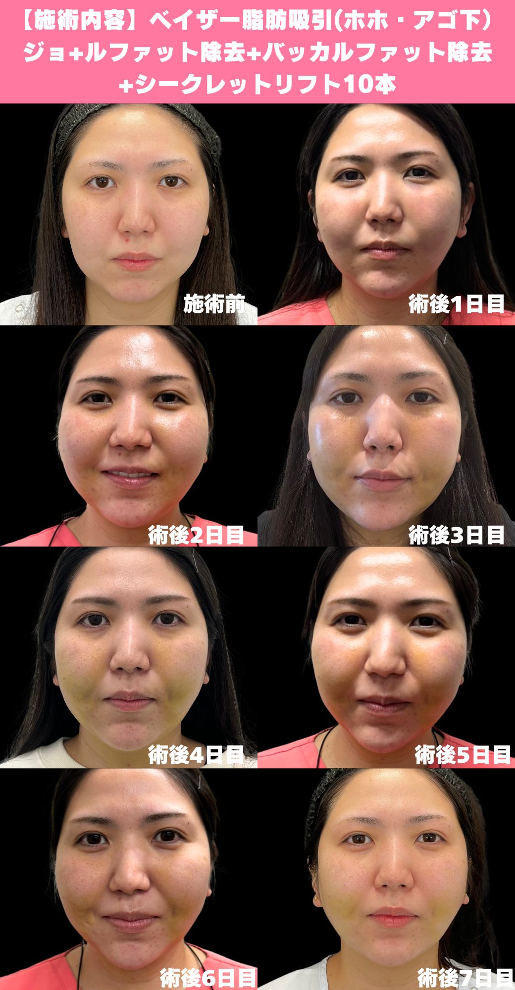 一毛布で大活躍！賃貸暮らしの救世主♪賃貸生活のしあわせは、この「万能な一枚」にかかってる！✨#賃貸暮らしの必須アイテム#一枚で何役も#楽々お... |  TikTok, image size:1040x2000