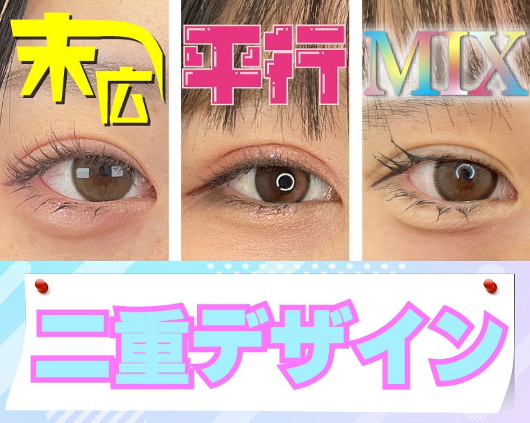 【二重整形】末広・平行・MIX型とは？埋没のデザイン徹底解説！千葉県・津田沼院