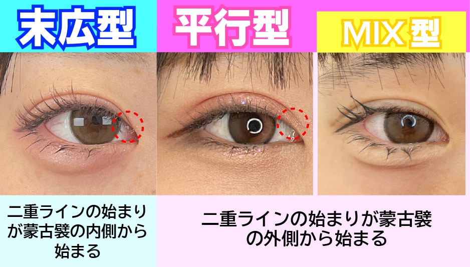デザインは大きく分けて「3つ」