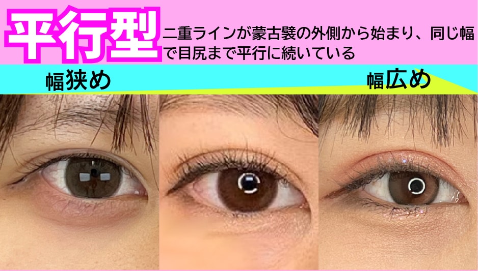 【平行型】綺麗め華やかな目に