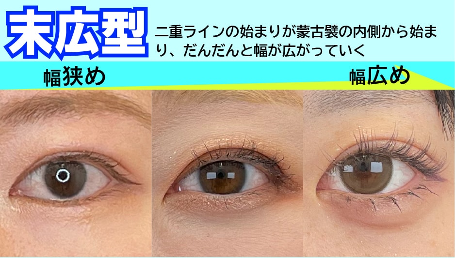 【末広型】かわいらしい目代表!