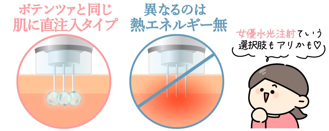 お値段はポテンツァの半額ほど？