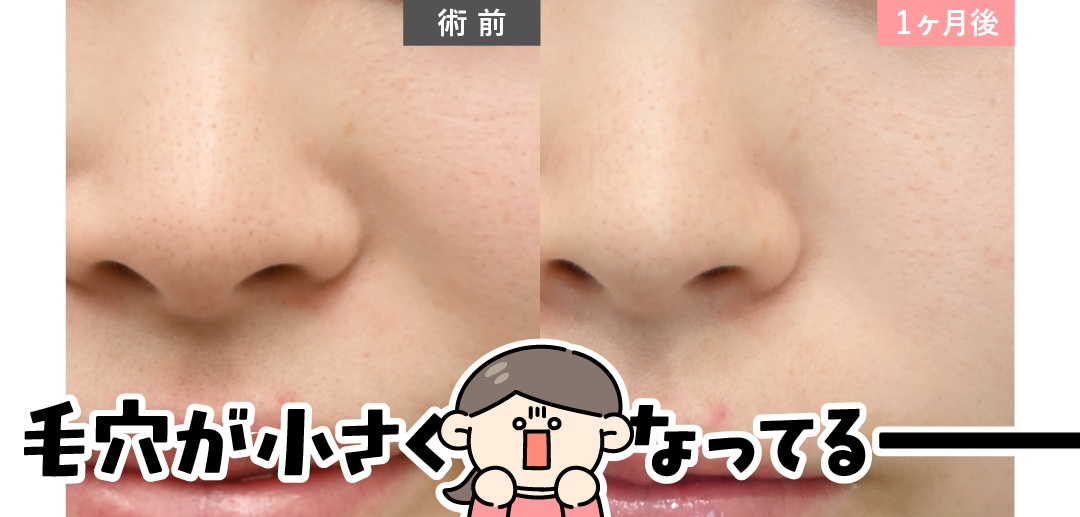注入される“薬剤成分のこだわり”