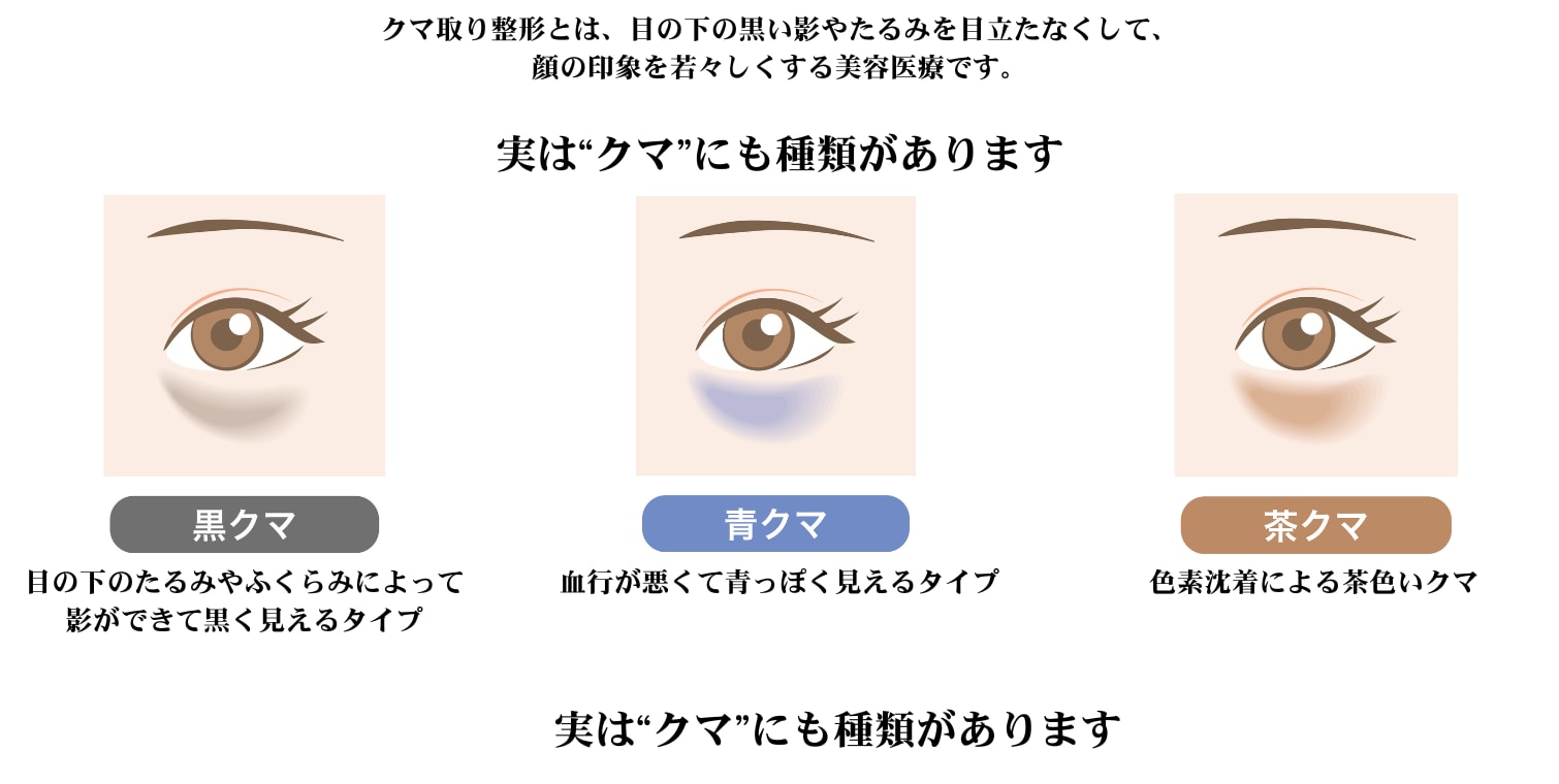―「切る」方法も「切らない」方法もある!自分に合った治療を選べる時代