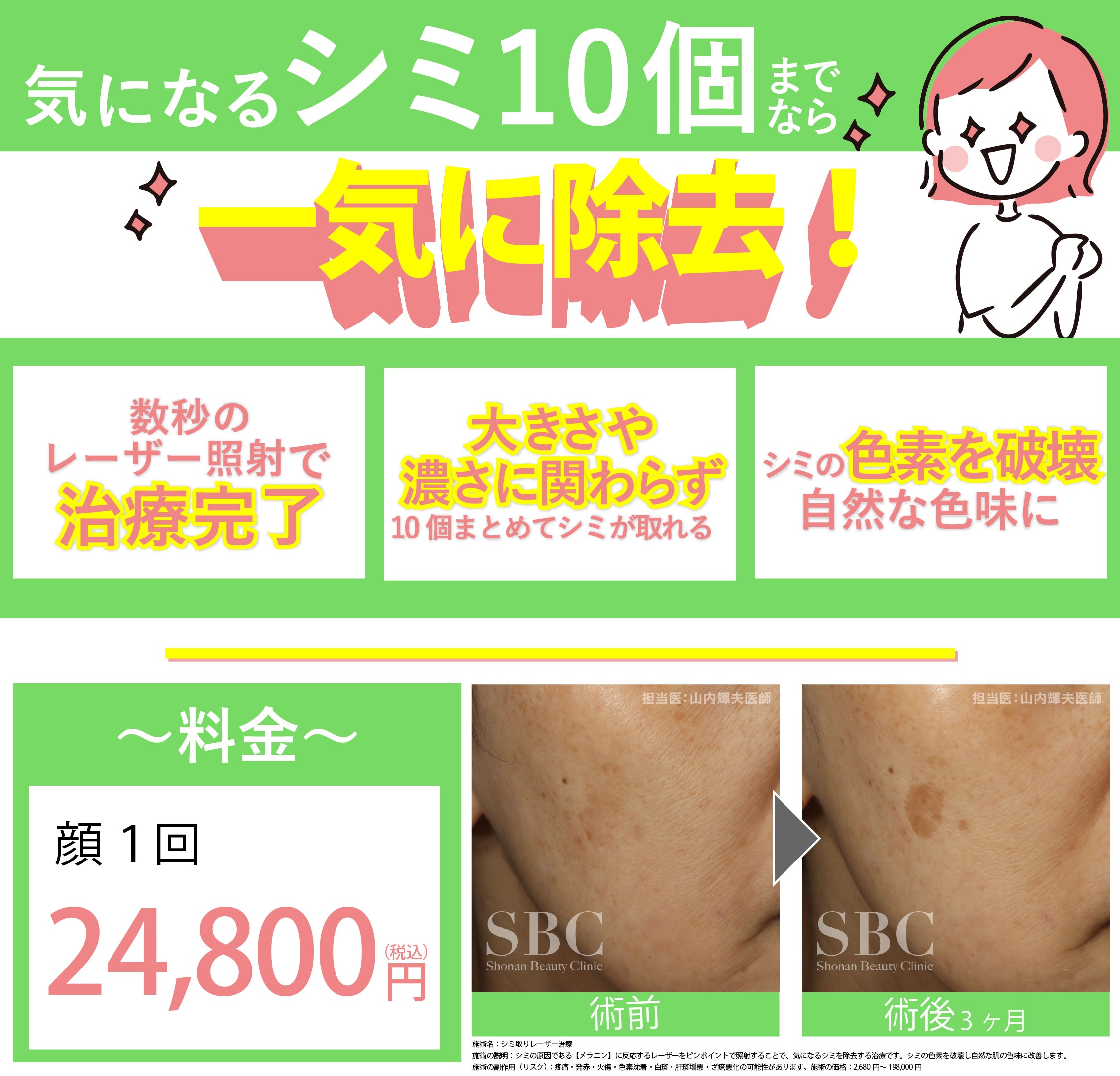 シミ取りレーザー10