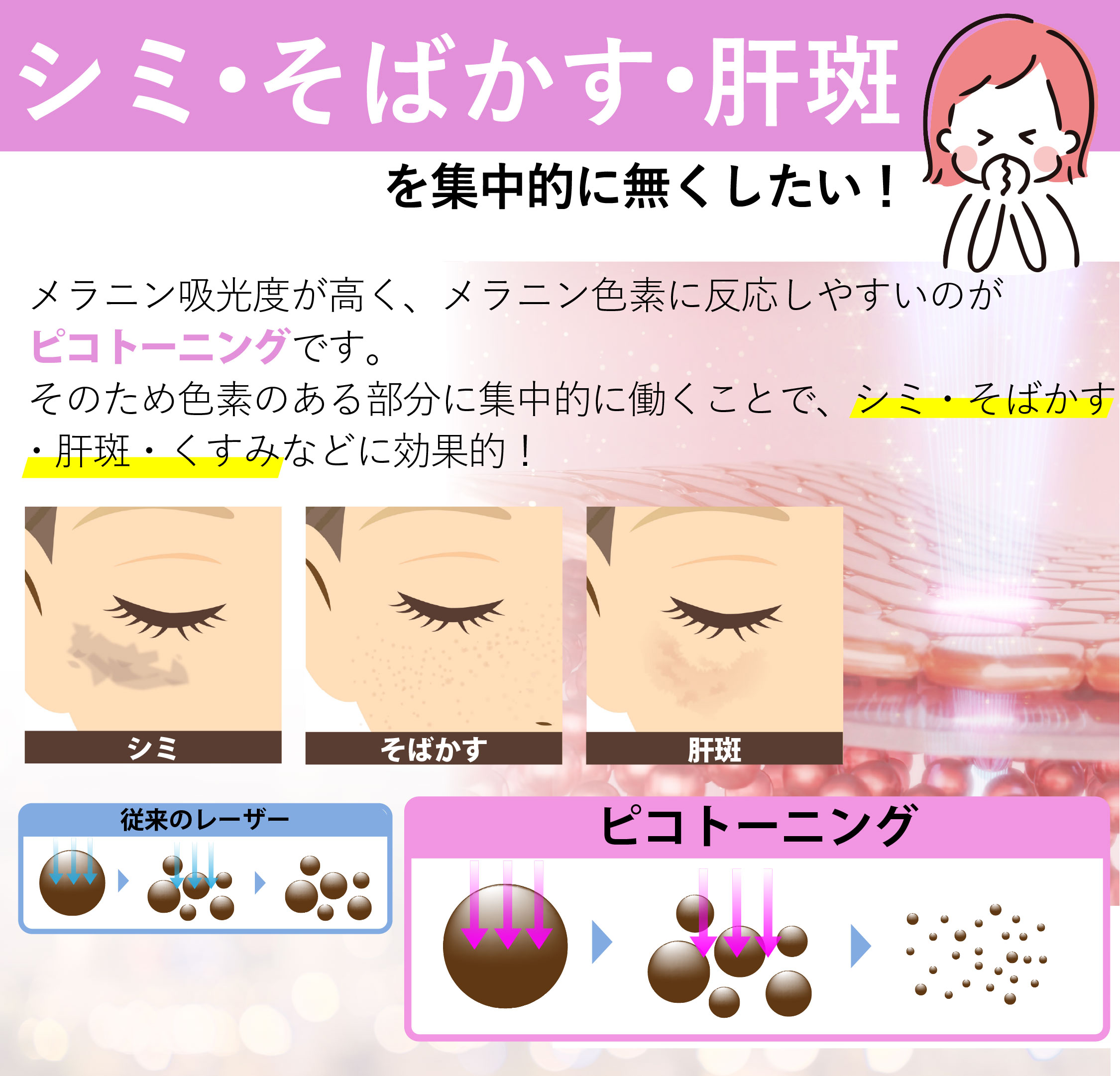 ピコトーニング