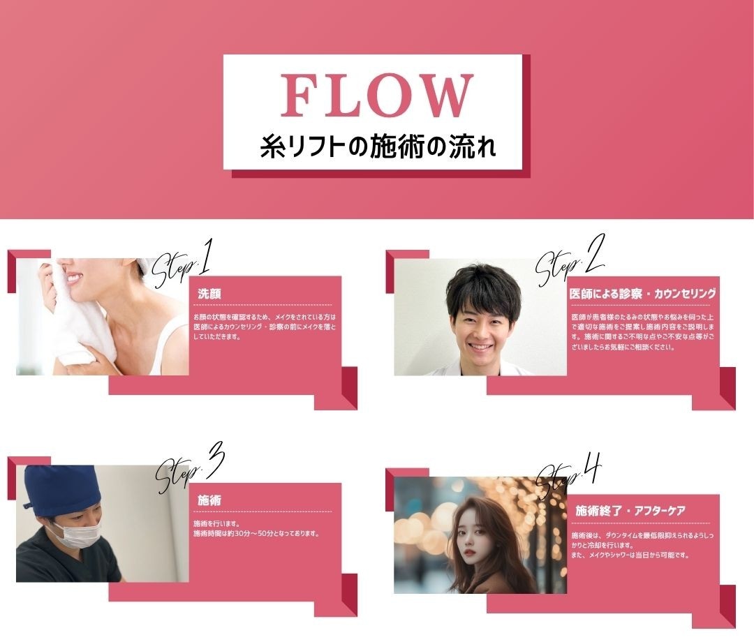 糸リフト施術の流れ図