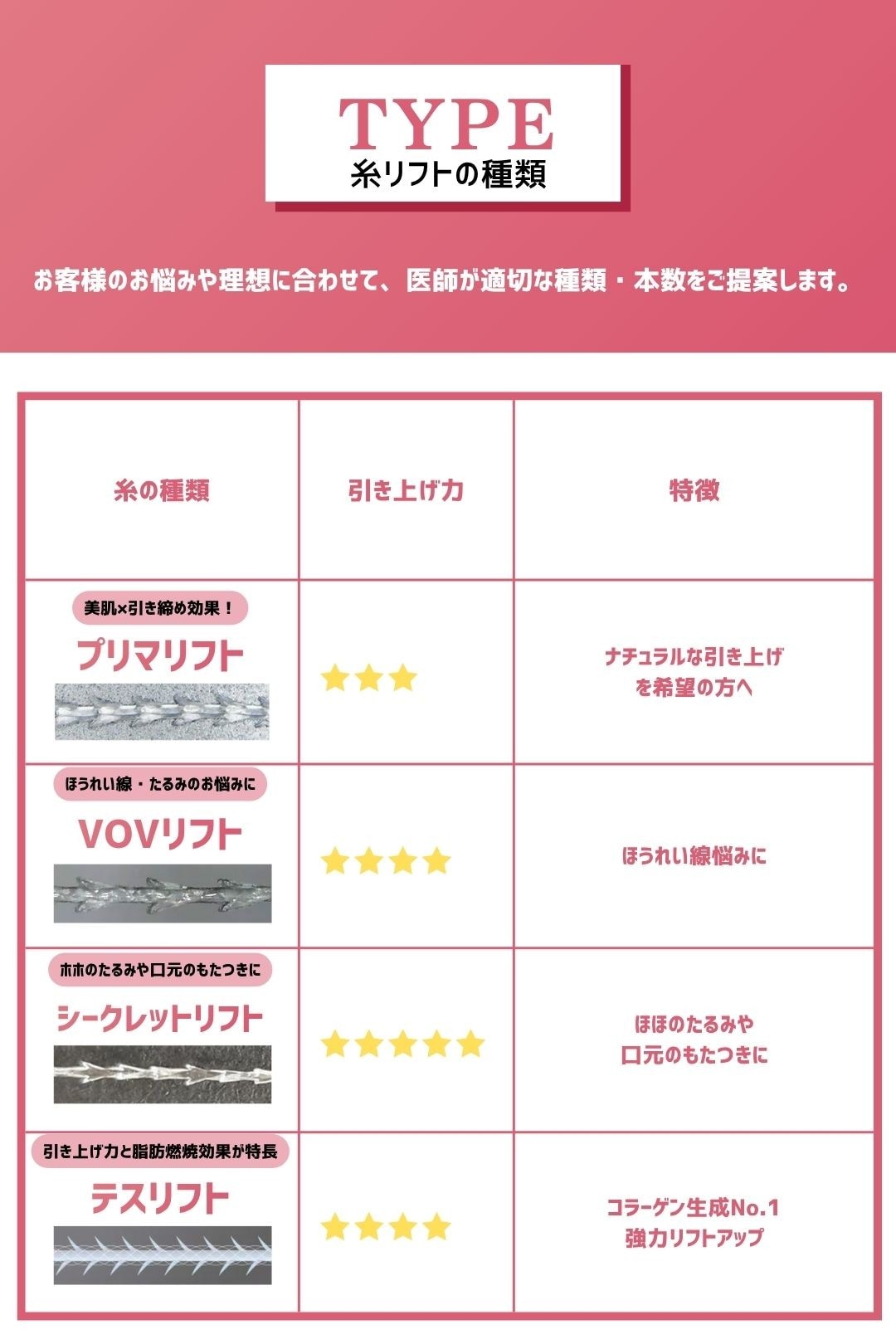 糸リフト種類の比較図